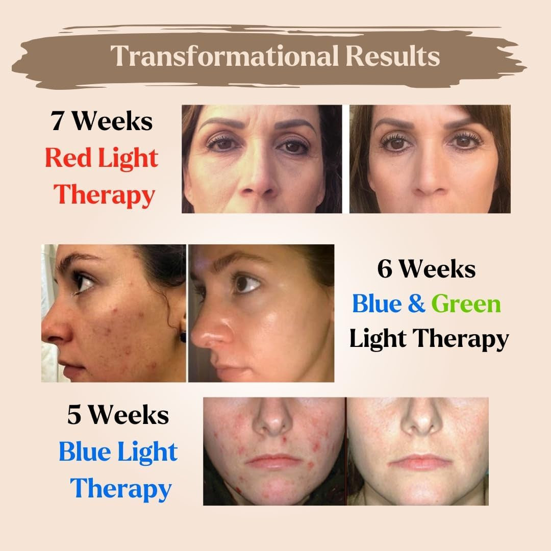 Led Face Mask Light Therapy - Dermawave 7 Colors Light Therapy Mask with 10 Pcs