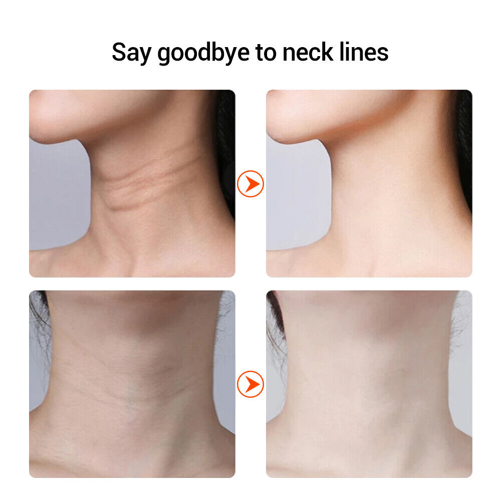 Skin Tightening Machine RF LED Light Photon Therapy Face Massager Facial Beauty